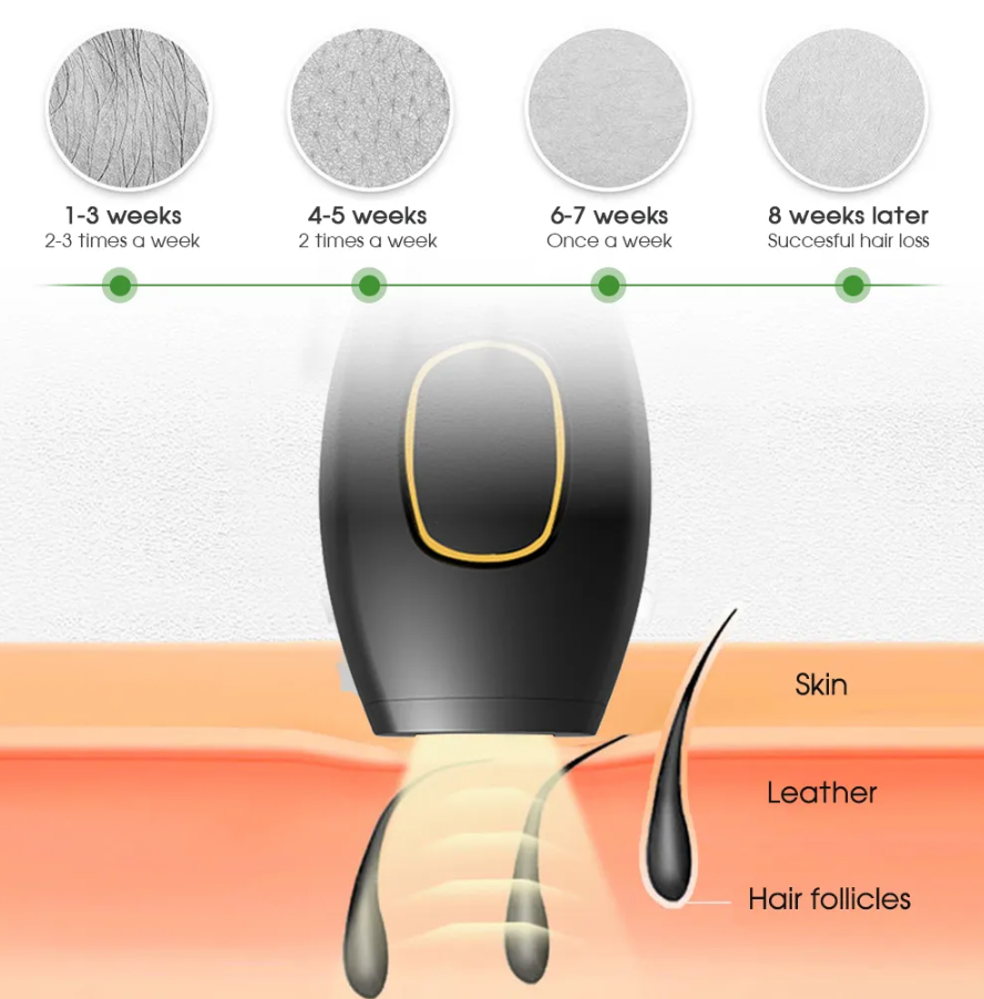 Zs-Depilazione laser permanente indolore per donna, bikini, 500.000 flash, depilazione indolore, dispositivo per uso domestico