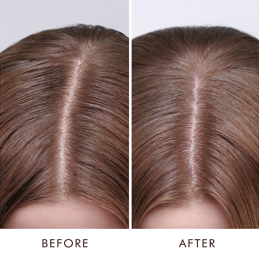 Moroccanoil Dry Scalp Treatment, 1.5 Fl. Oz.