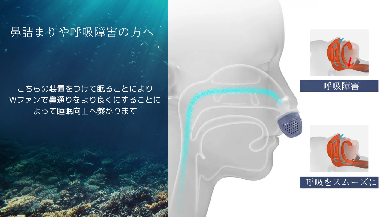 いびきや無呼吸に悩んでいる方へ今よりも睡眠の質を向上する電気いびきデバイス YOUPLUS