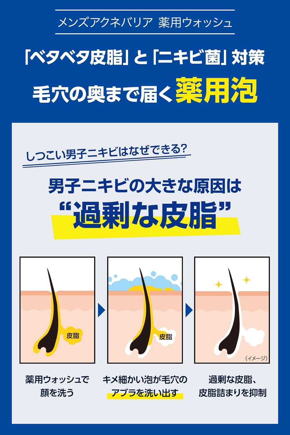 メンズアクネバリア 薬用ウォッシュ 男子ニキビ菌+ベタベタ皮脂すっきり洗い流す洗顔料【殺菌/抗炎症/低刺激処方】医薬部外品 100g