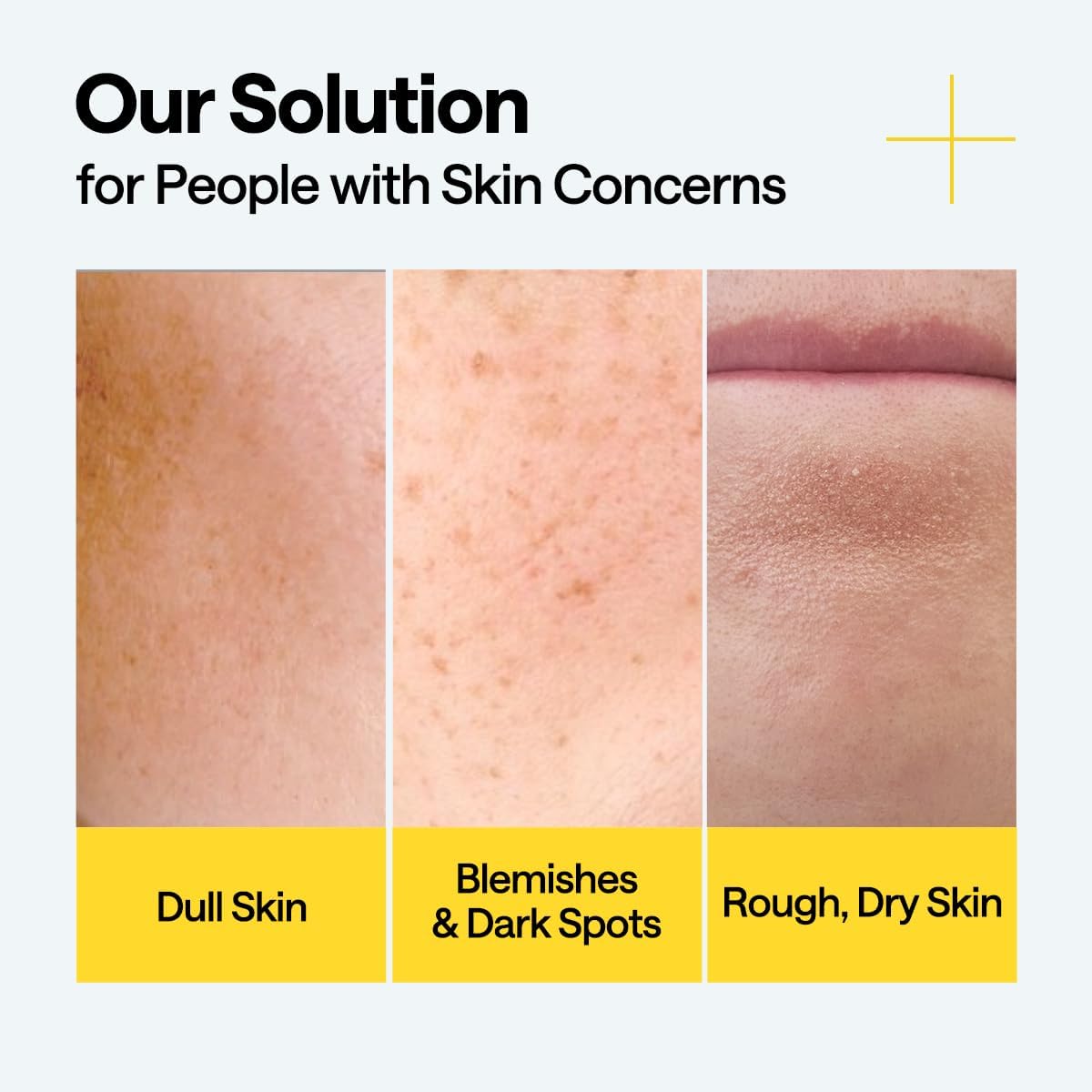 Mediheal Vitamin C Brightening Serum, 1.4 fl oz (40 ml), Vitamin Essence