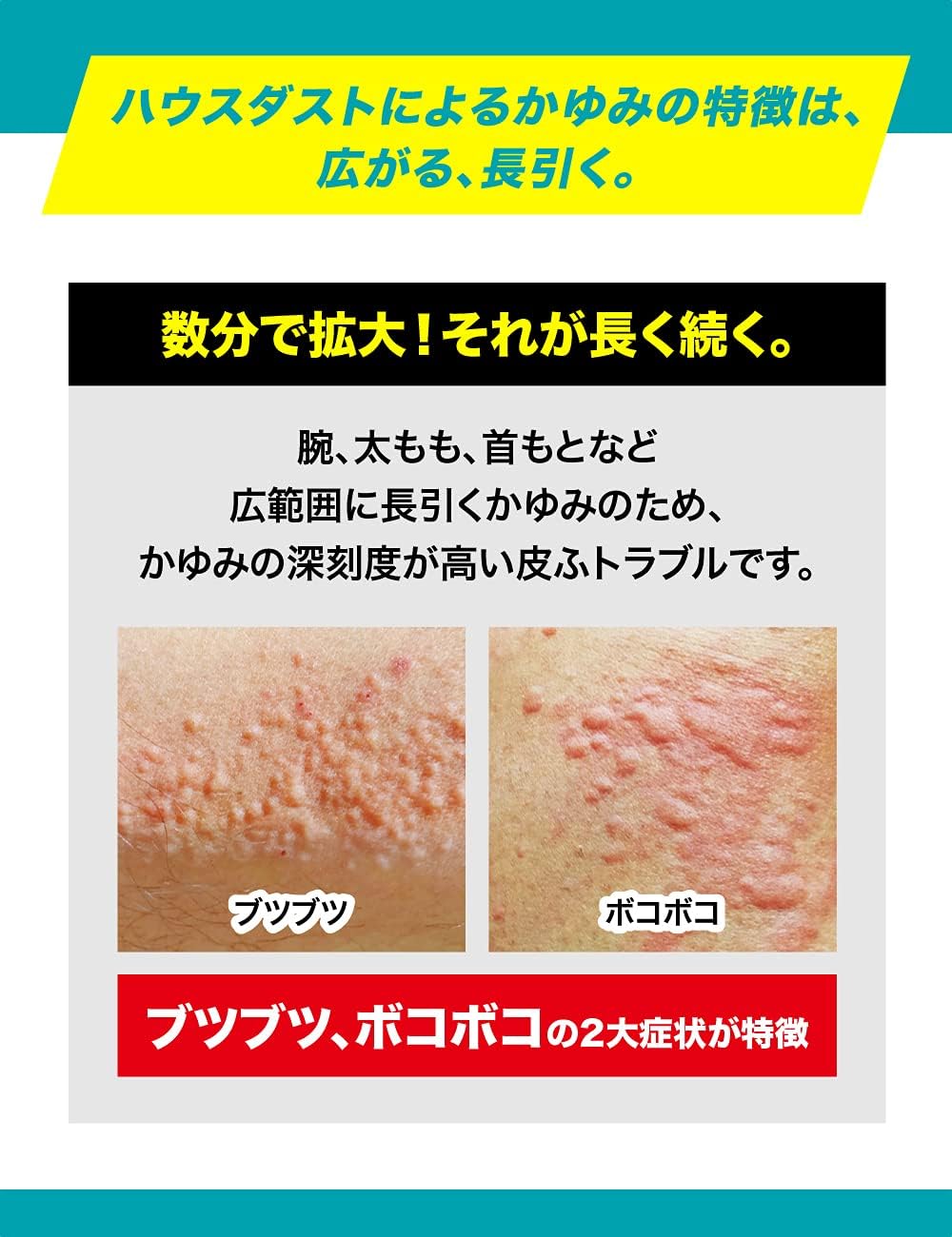 【第3類医薬品】ムヒダストメル 15g