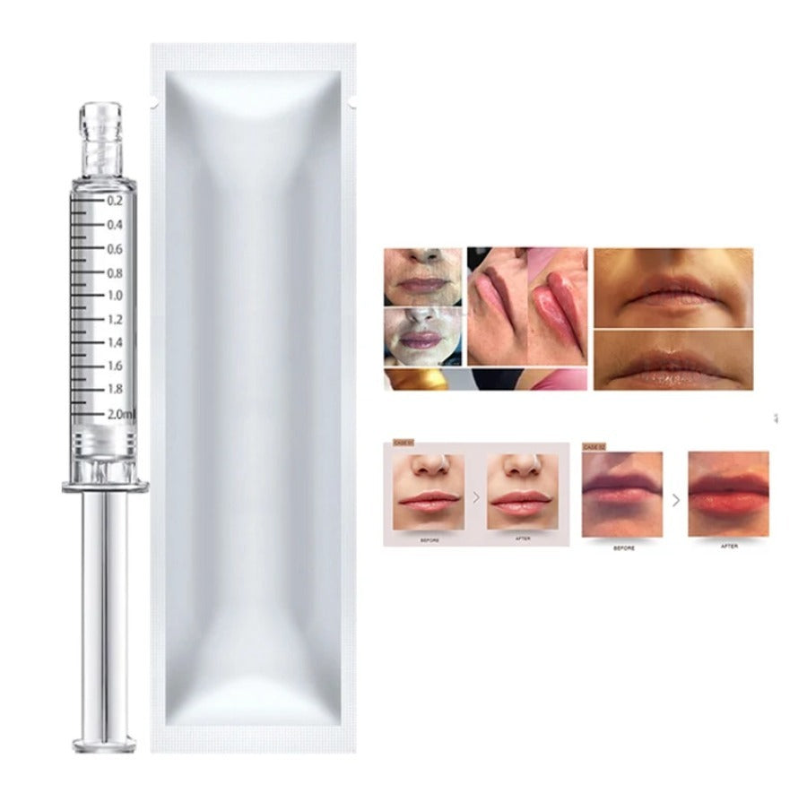 Korean Hyaluronic Acid Dermal Filler – Lip Plumping, Wrinkle Care, Nasolabial Lines, Nose & Forehead
