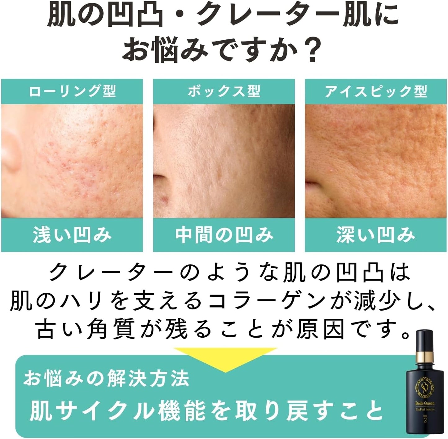 Dr. Re9 Bell Queen Exopir Hypoallergenic Introduction Beauty Essence (Uneven and Uneven Skin for Smooth Skin), Turnover Care Ingredient PPP3 Formulation, Rough Skin, Trace Countermeasure (Booster