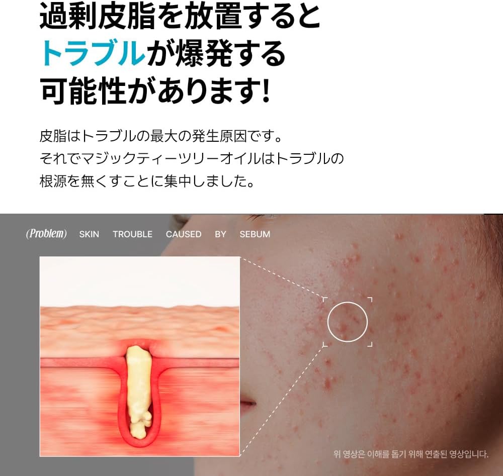 BLANC Official Magic Tea Tree Oil, 0.7 fl oz (20 ml), Skin Trouble, Serum, Sensitive Skin, Mask, Korean Cosmetics, Pigmentation, Face Oil, Unisex Body, Skin Care