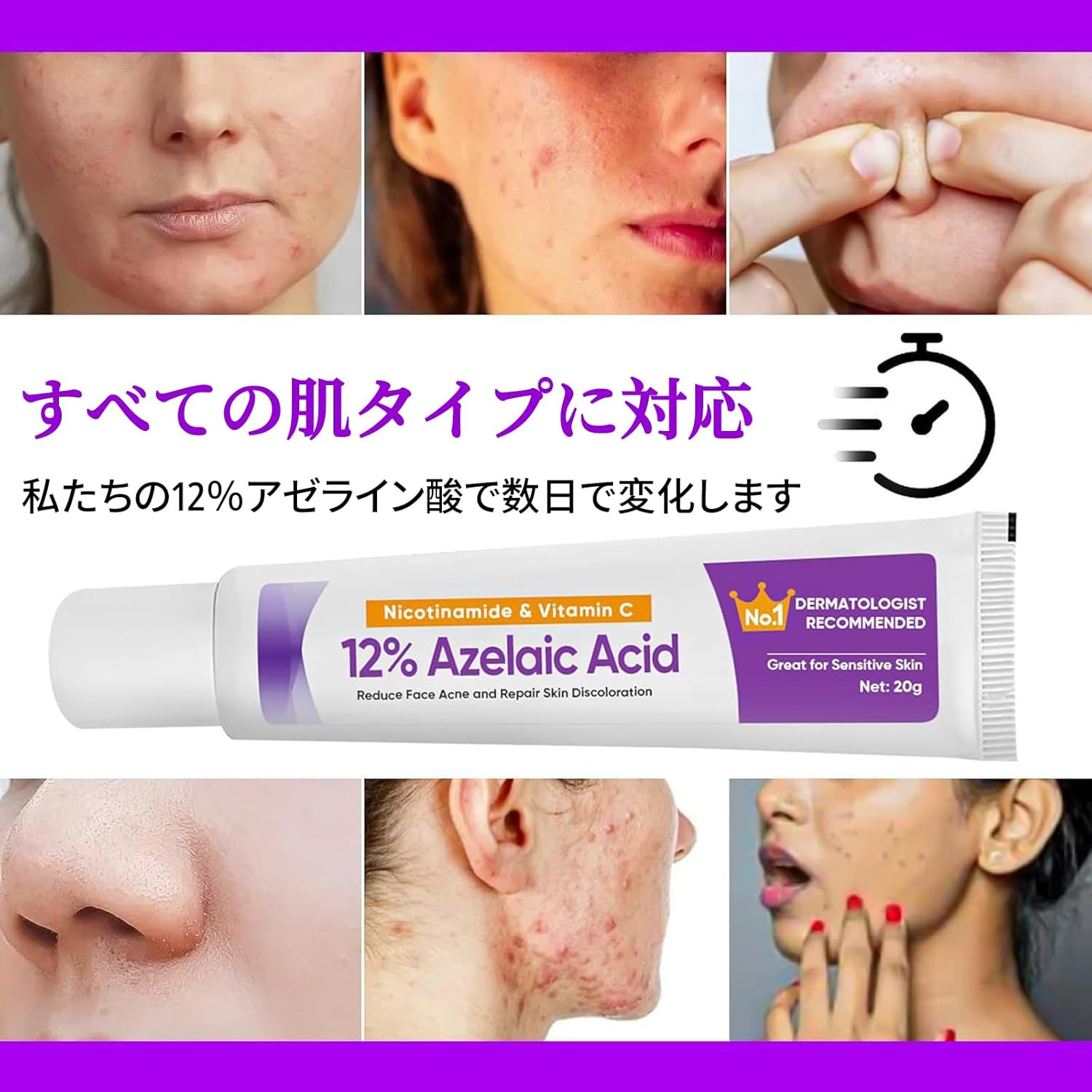 [Popular] Snail Extract Cream, Moisturizing, Facial for Women, Hyaluronic Acid and Snail Extract Formulated (Azelaic Acid Cream, 0.7 oz (20 g)