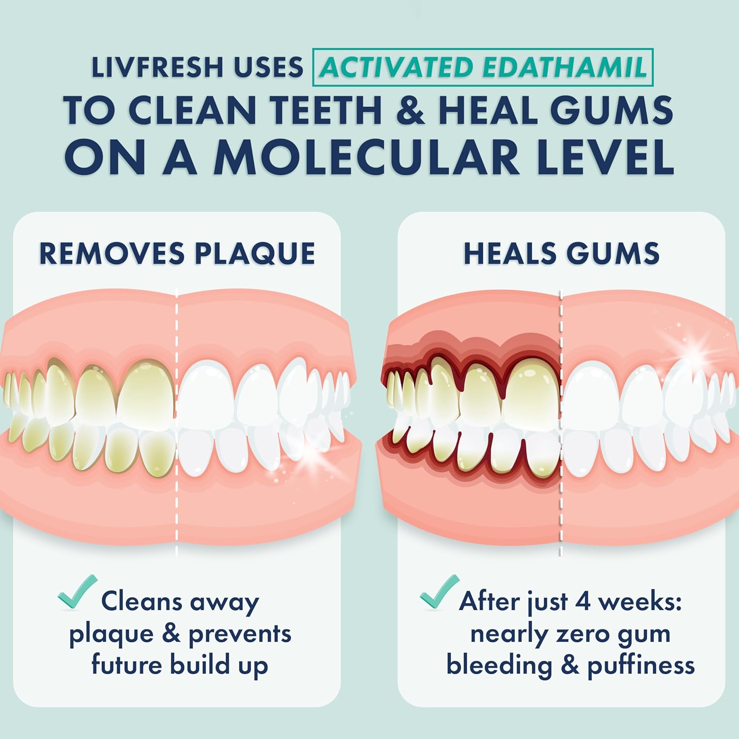 LivFresh Gel de pasta de dientes, clínicamente probado para eliminar la placa un 250% mejor, mejora la salud de las encías un 190% mejor, previene y reduce el sarro, refresca el aliento, gel dental