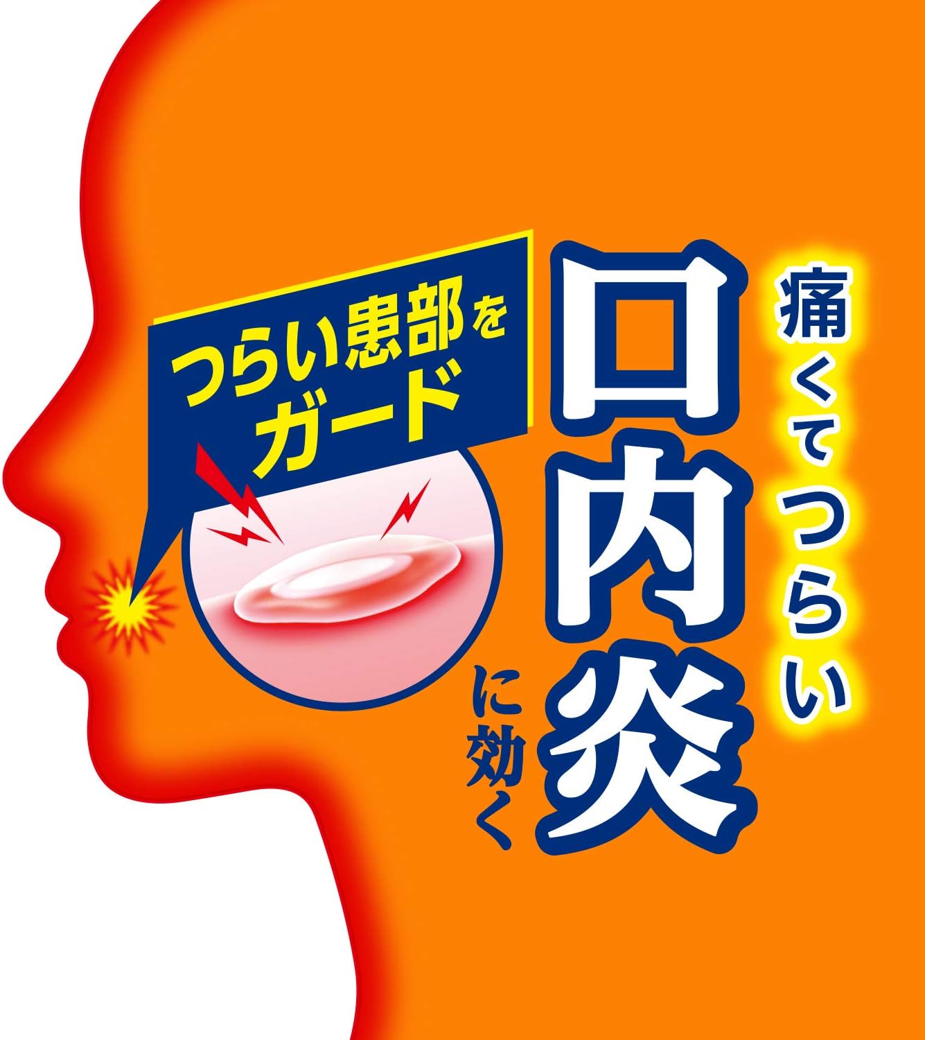 【指定第2類医薬品】アフタガード 5g