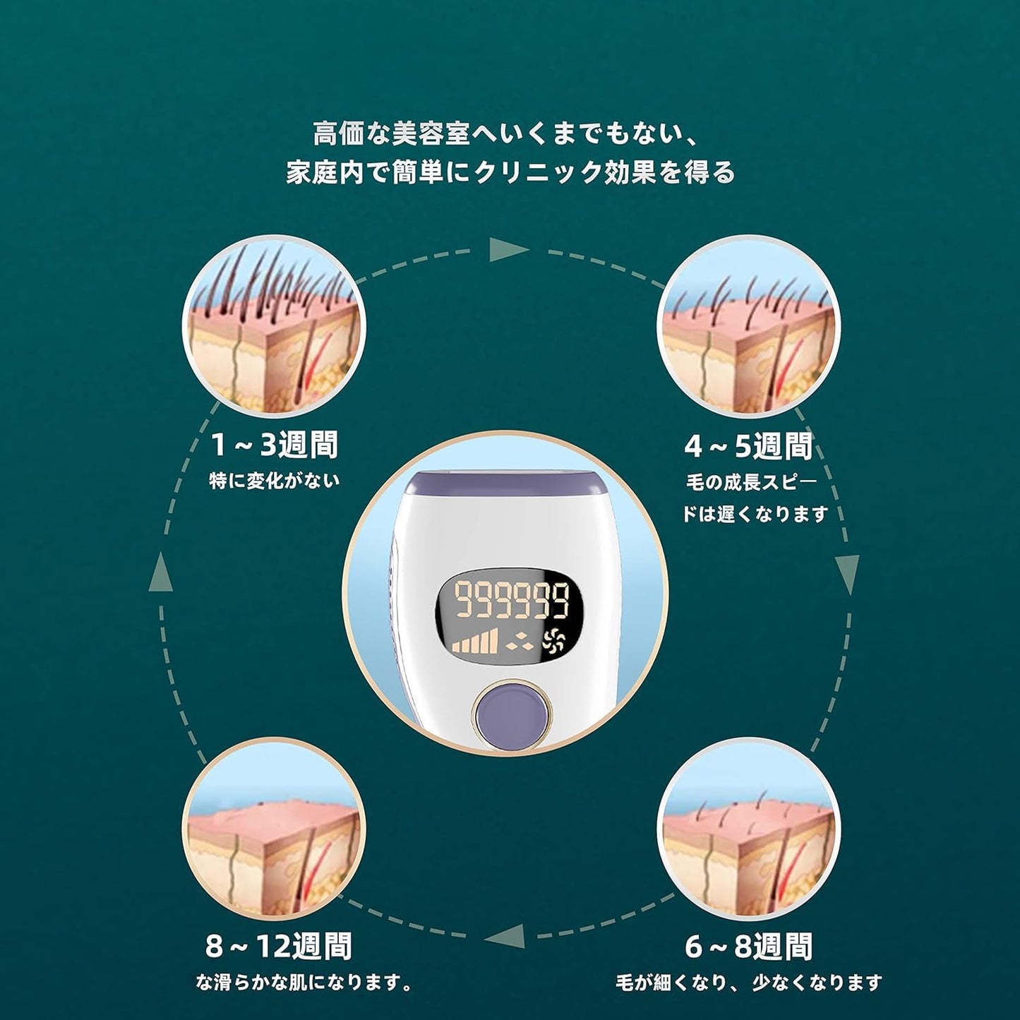 ZAPAL Epilator, 990,0000 Irradiation, IPL Light Epilator, VIO Compatible, Full Body Hair Removal, Household Epilator, 5 Levels, Flash Hair Removal, Sunglasses Included, Waste Hair Treatment, Full Body