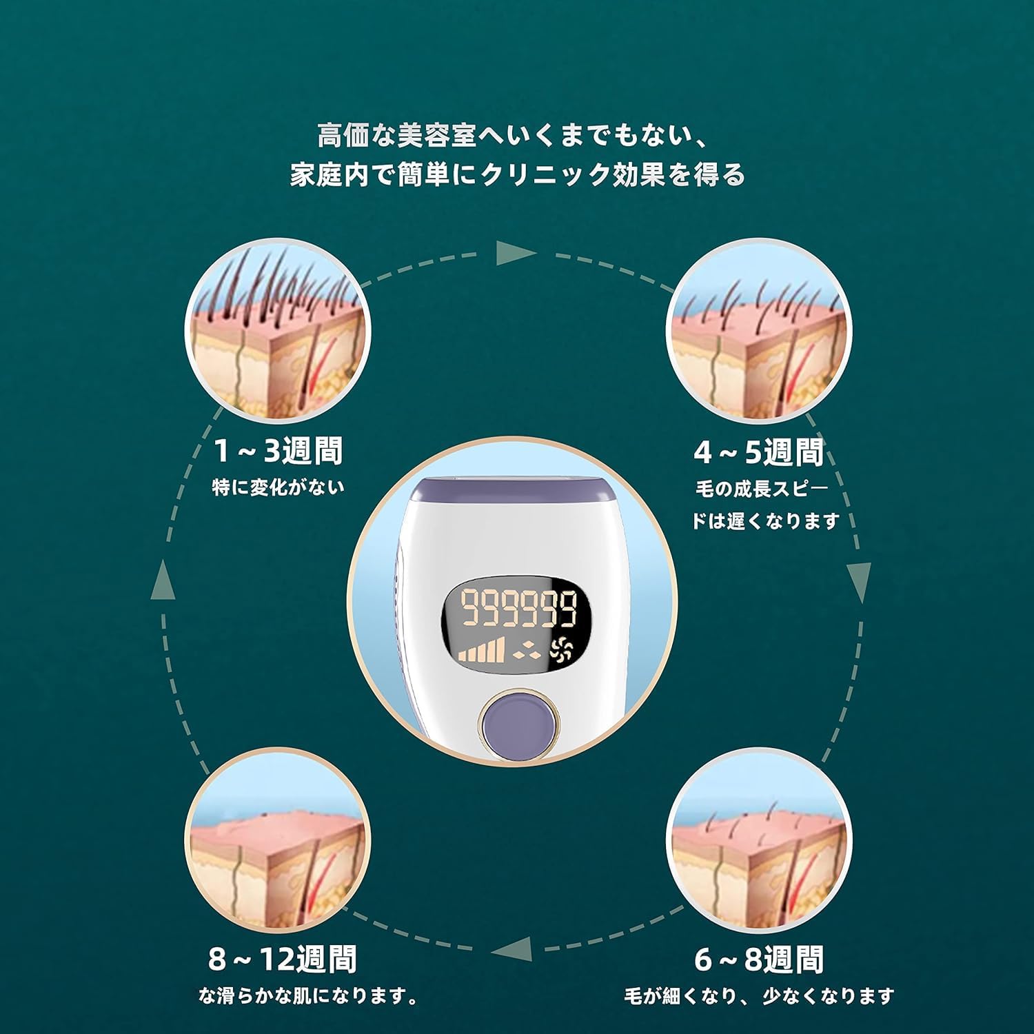 ZAPAL Epilator, 990,0000 Irradiation, IPL Light Epilator, VIO Compatible, Full Body Hair Removal, Household Epilator, 5 Levels, Flash Hair Removal, Sunglasses Included, Waste Hair Treatment, Full Body