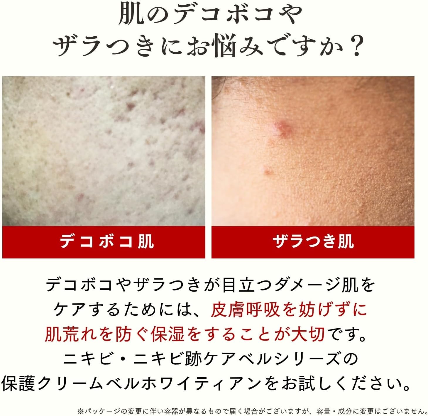 Dr. Re9 Belle Whitetian Rough Skin Cream, Supports Skin Breathing and Rough Skin (Care for Rough Skin, Rough Skin, Dryness Care), Unique Ingredients Nano Acne Formulation, Does Not Clog Pores, Skin