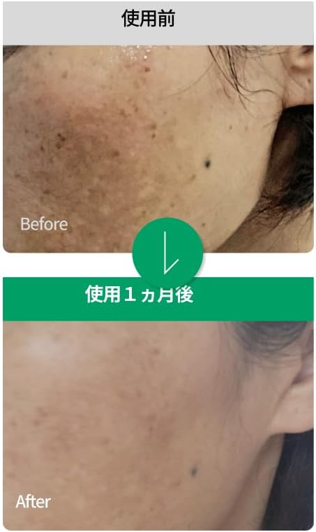 [Official] Easy Dew Mela One Day Serum, 0.3 fl oz (10 ml) (Stains/Dullness/Tone Up/EGF/Skin Barrier/Doctor's Skin Care)