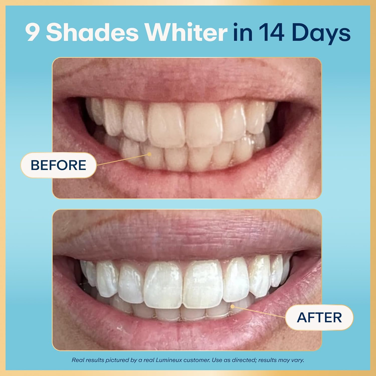 Kit de tiras blanqueadoras dentales Lumineux - 9 tratamientos - sin peróxido - seguro para el esmalte para dientes más blancos - blanqueamiento sin sensibilidad - formulado por dentistas - sin