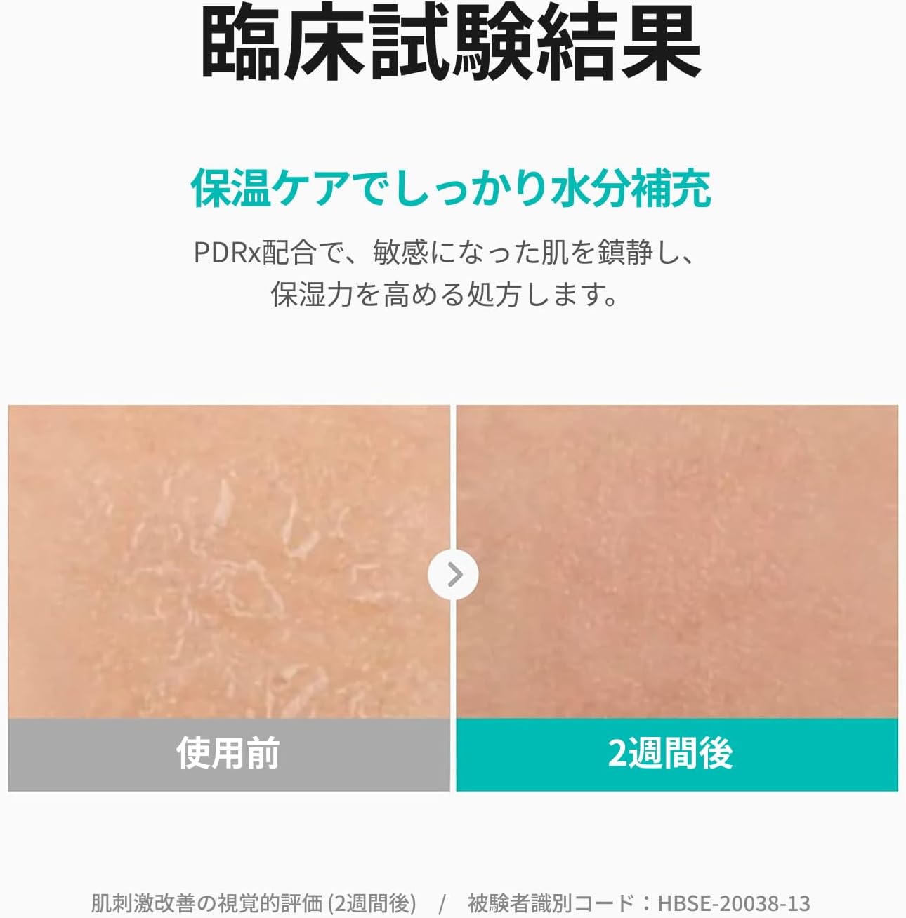 Official REJURAN Derma Healer Moisture Cream 2.1 oz (60 g) Skin Care Korean Cosmetics