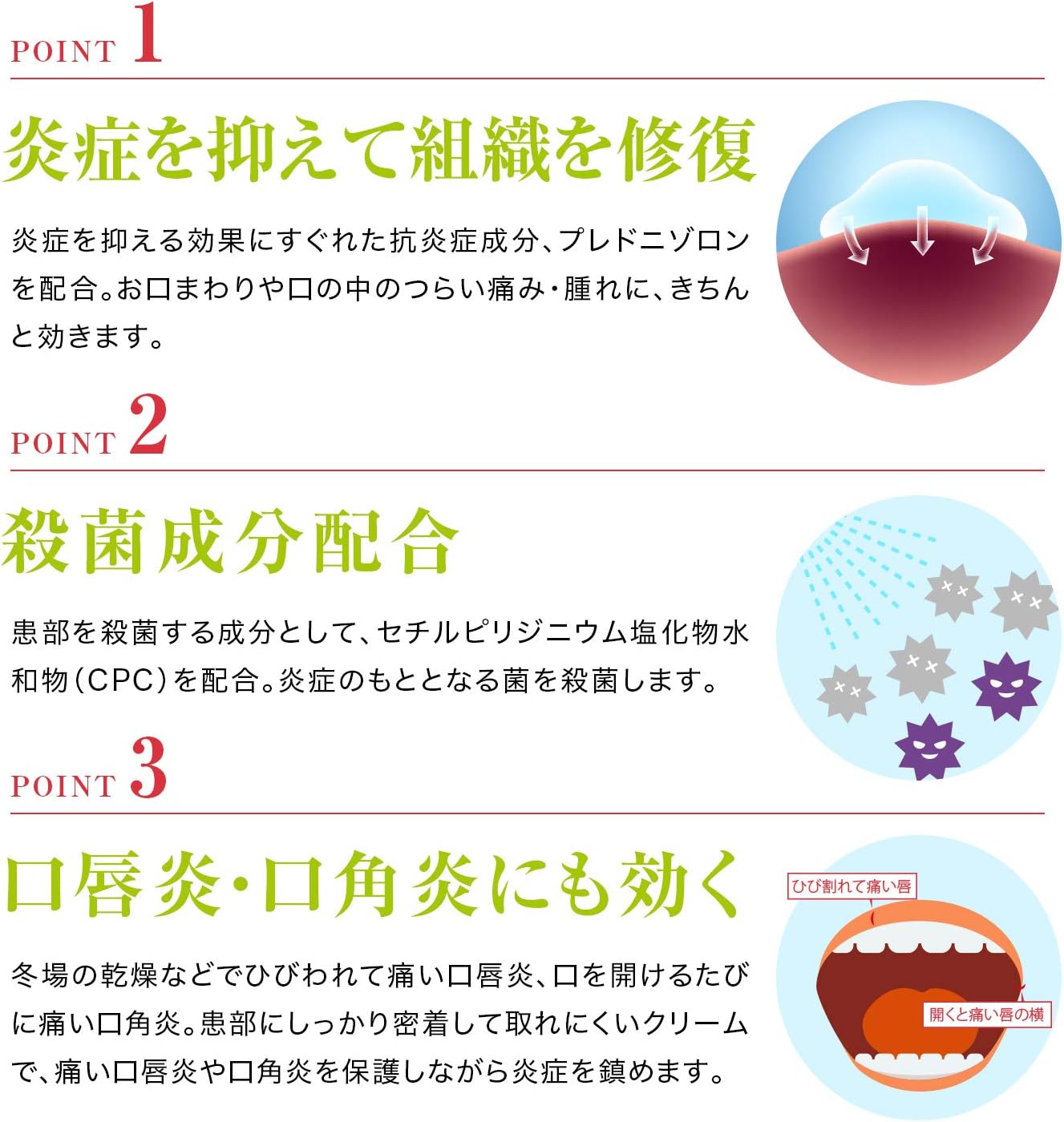 【指定第2類医薬品】デンタルピルクリーム 5g