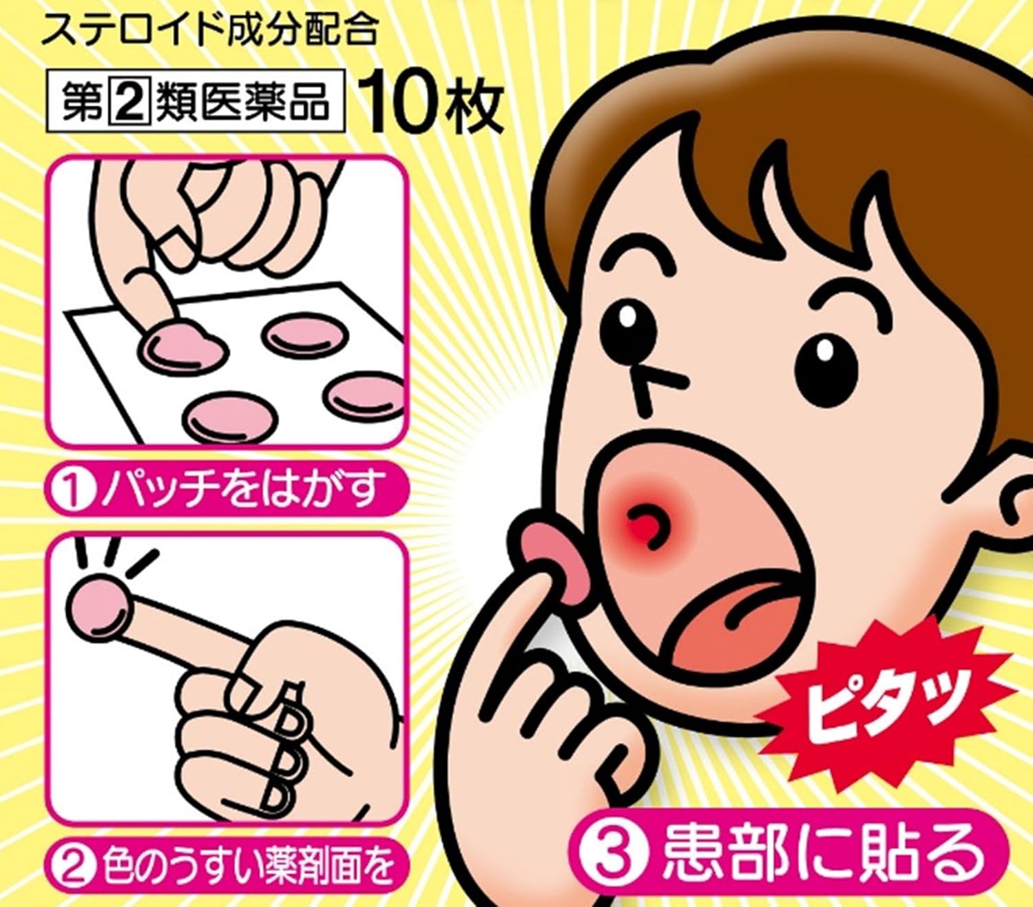 【指定第2類医薬品】口内炎パッチ大正クイックケア 10枚