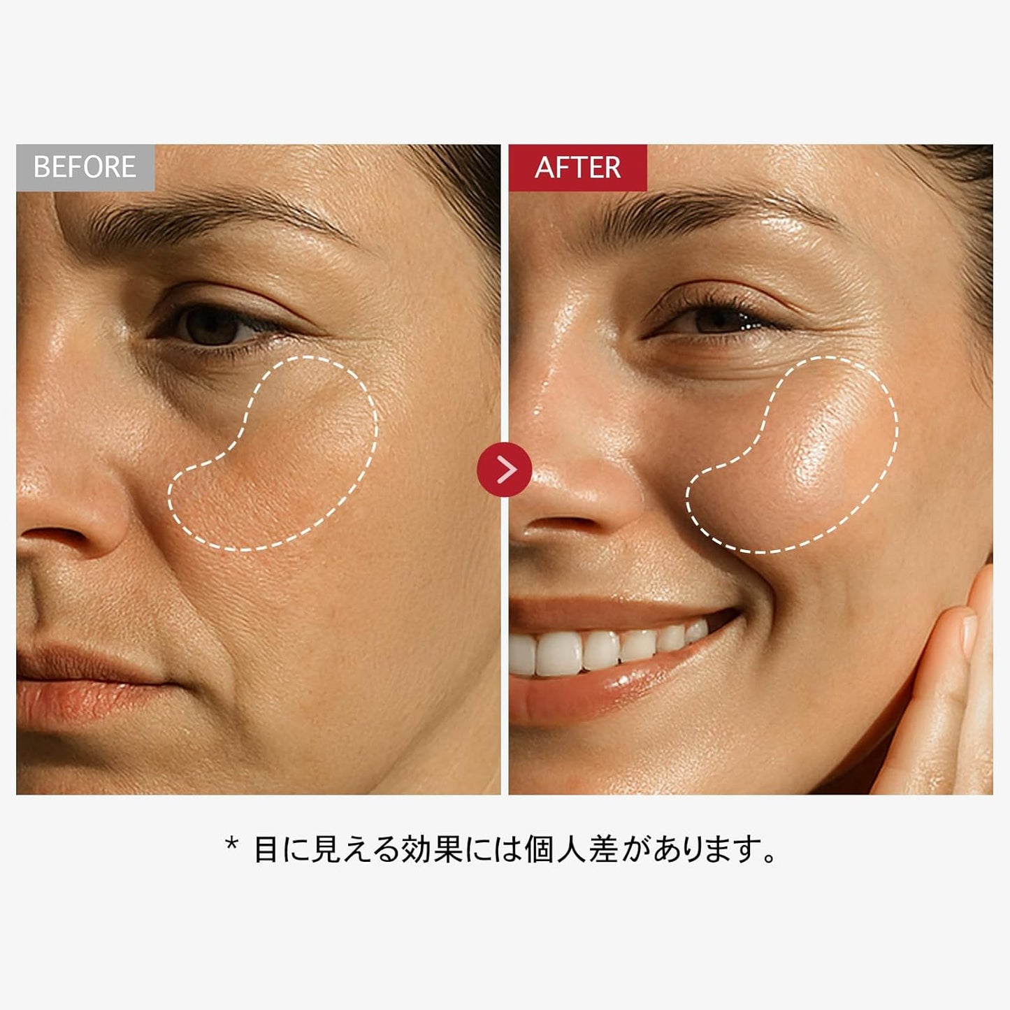 TOSOWOONG Real Collagen Face Cream, 1.7 fl oz (50 ml), Collagen, Moisturizing, Moisturizing, Skin Texture, Glossy, Firming, Elasticity, Wrinkles, Dry, Korean Skin Care Cosmetics