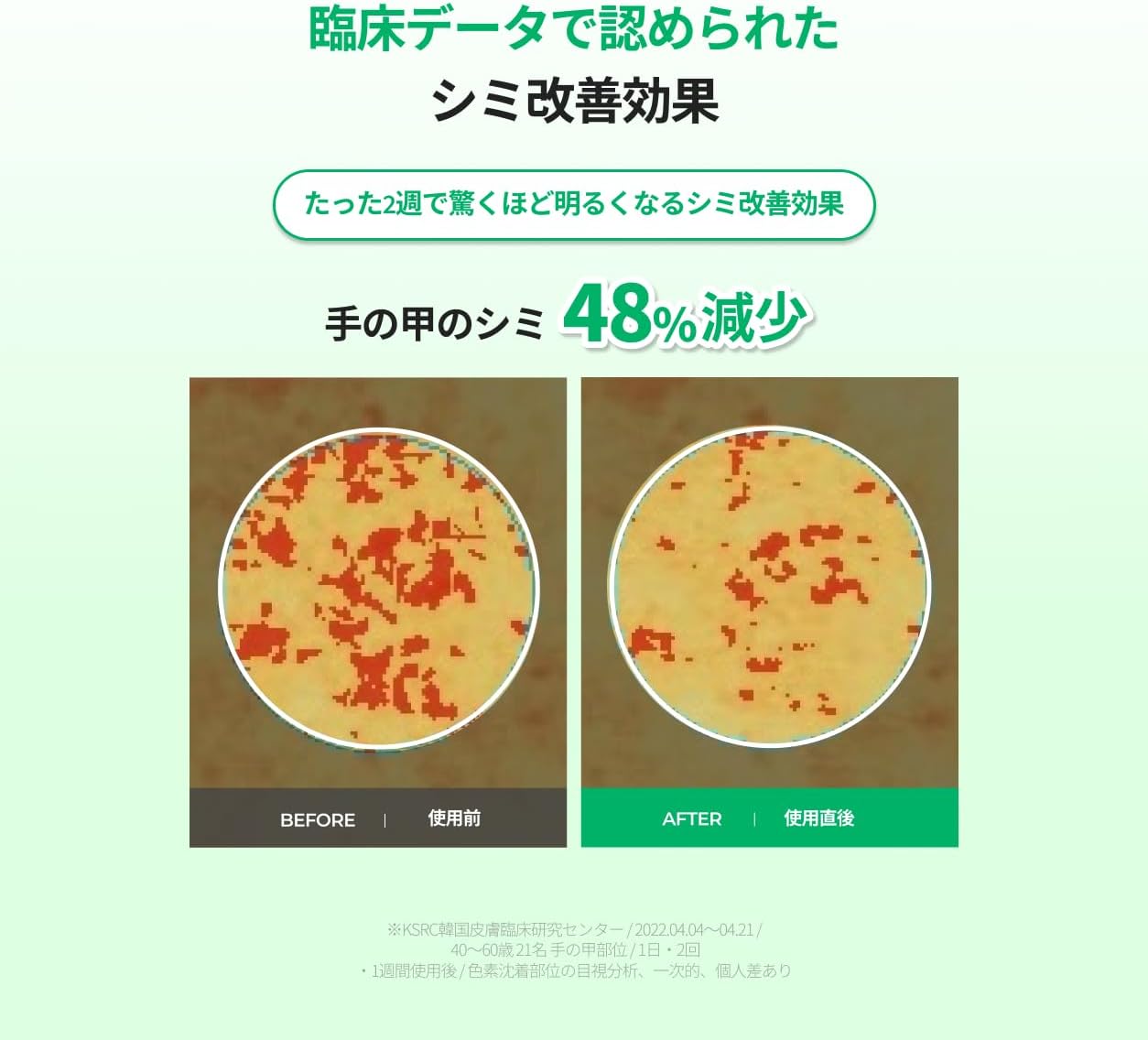 [Official] Easy Dew Mela One Day Serum, 0.3 fl oz (10 ml) (Stains/Dullness/Tone Up/EGF/Skin Barrier/Doctor's Skin Care)