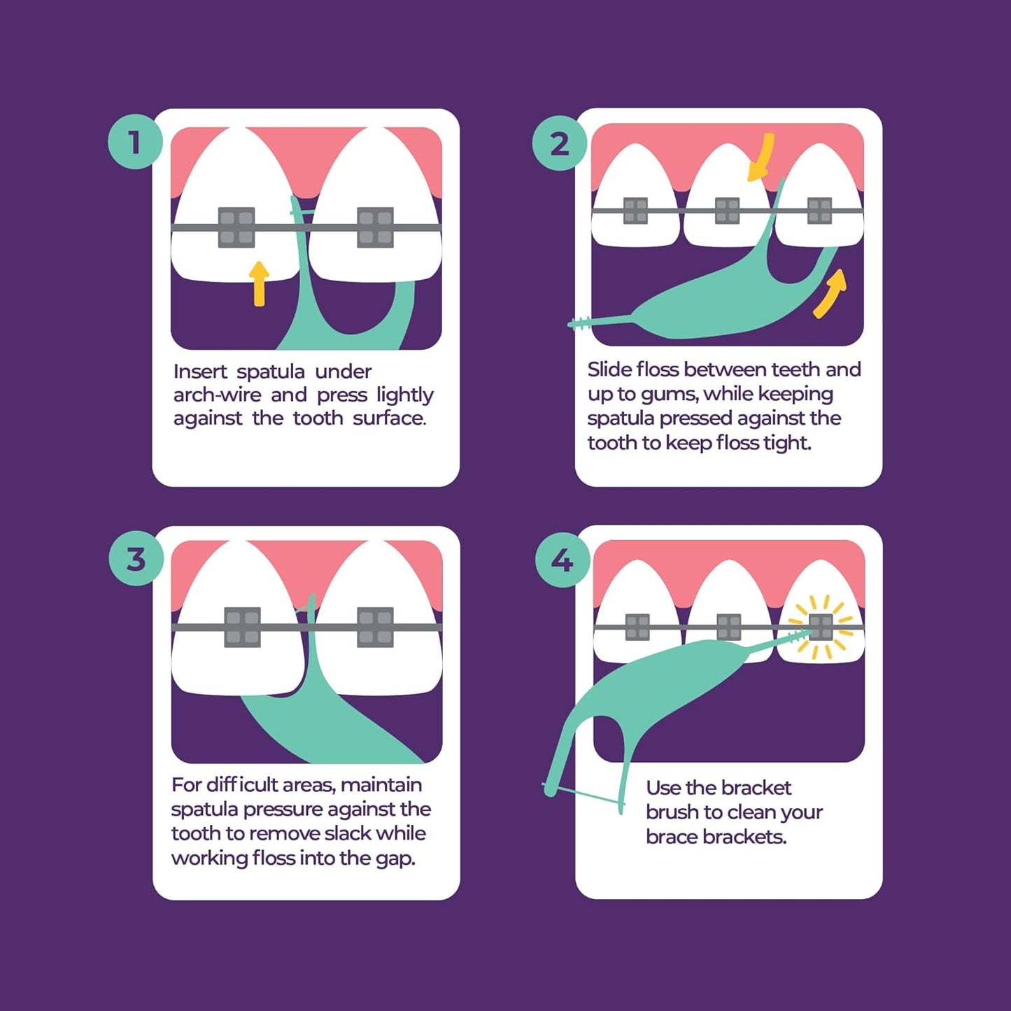 Platypus Hilo dental de ortodoncia para aparatos ortopédicos, 40 unidades (paquete de 1), púas ortográficas para adultos y niños, se adapta debajo del alambre del arco, no daña, fomenta los hábitos de