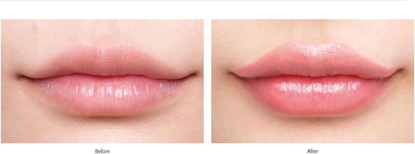 Fujiko Official: Fujiko Morning Lovely Gloss Lip Gloss Lip Care Lip Balm Lip Makeup Lip Primer Natural Makeup Tinted Lip Treatment Vertical Wrinkle Coverage