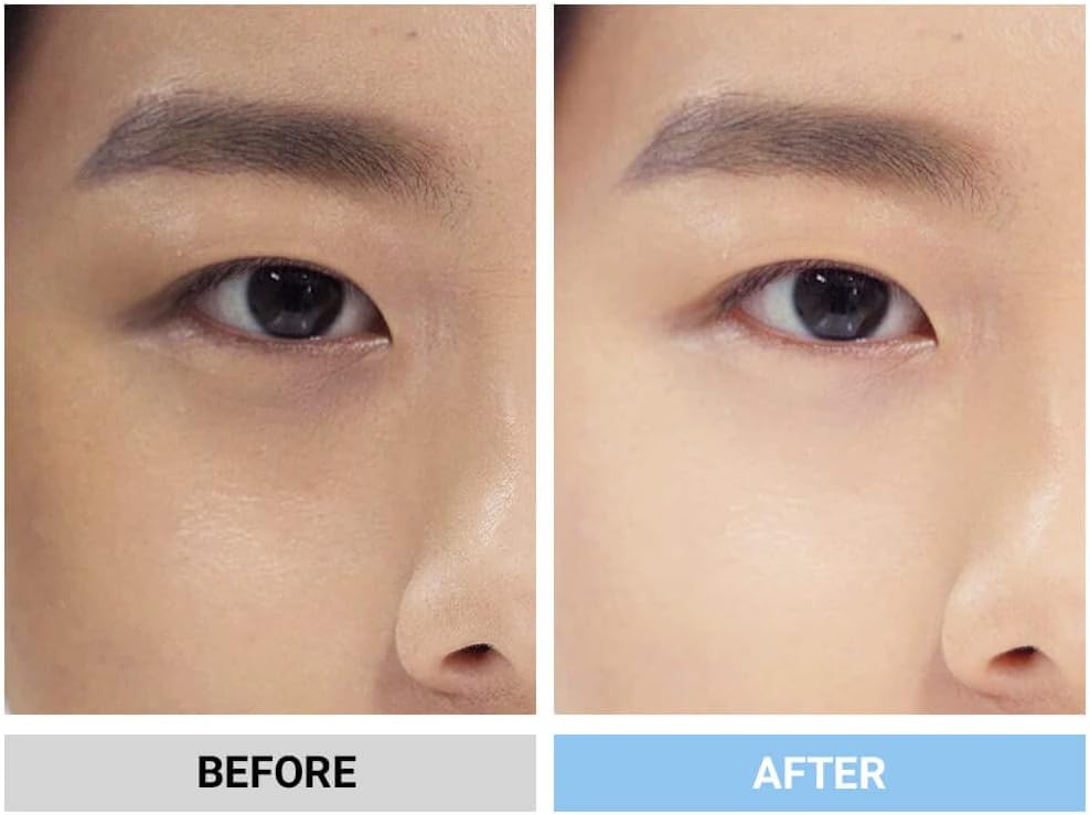 moremo Blemish Cover, BB Cream (Japan Authorized Dealer), Makeup Base, Sunscreen, Dullness, Acne, Semi-Matte (Light Beige)