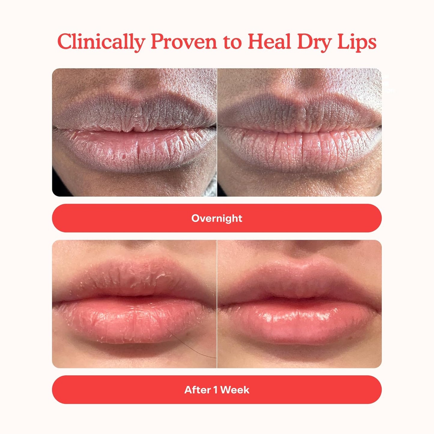 Tower 28 LipSoftie Bálsamo Labial Hidratante con Tinte, Mascarilla Labial Hidratante para Labios Agrietados - Sabor a Sandía Kiwi, Brillo Rosa Claro