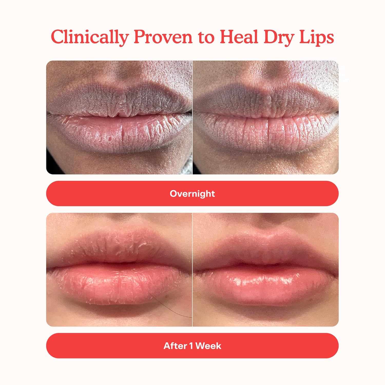 Tower 28 LipSoftie Bálsamo Labial Hidratante con Tinte, Mascarilla Labial Hidratante para Labios Agrietados - Sabor a Sandía Kiwi, Brillo Rosa Claro