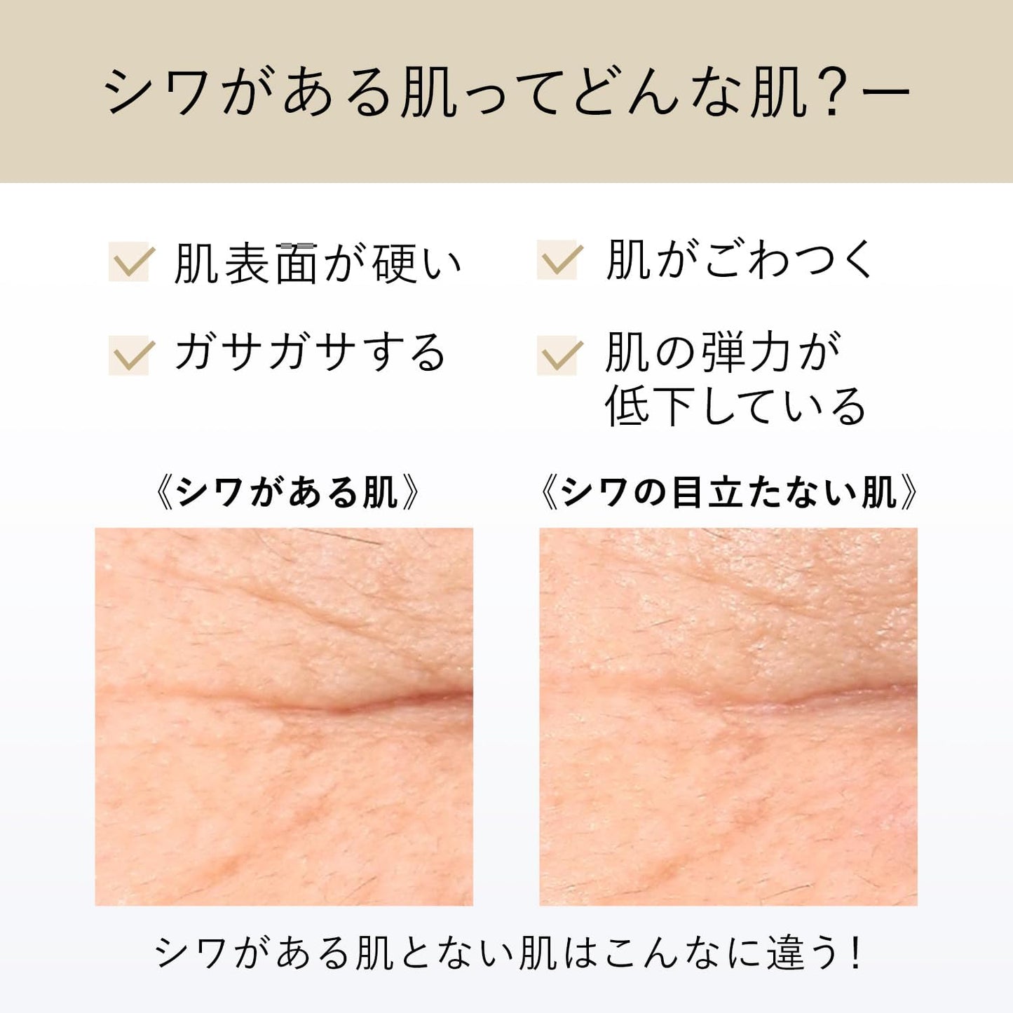 ELIXIR Elixir Retino Power Wrinkle Cream, 0.8 oz (22 g) + 0.1 oz (4 g), Quasi-drug, Milky Lotion, Pure Retinol, Wrinkle Improvement, Aging Care, Shiseido