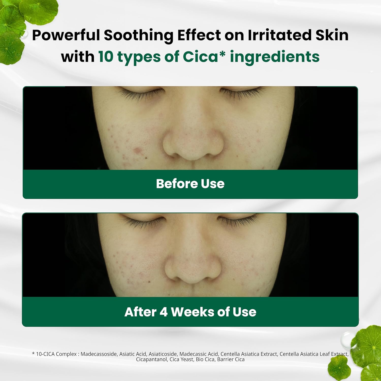 Dr. G. R.E.D Blemish Clear Soothing Cream, 1.7 fl oz (50 ml)