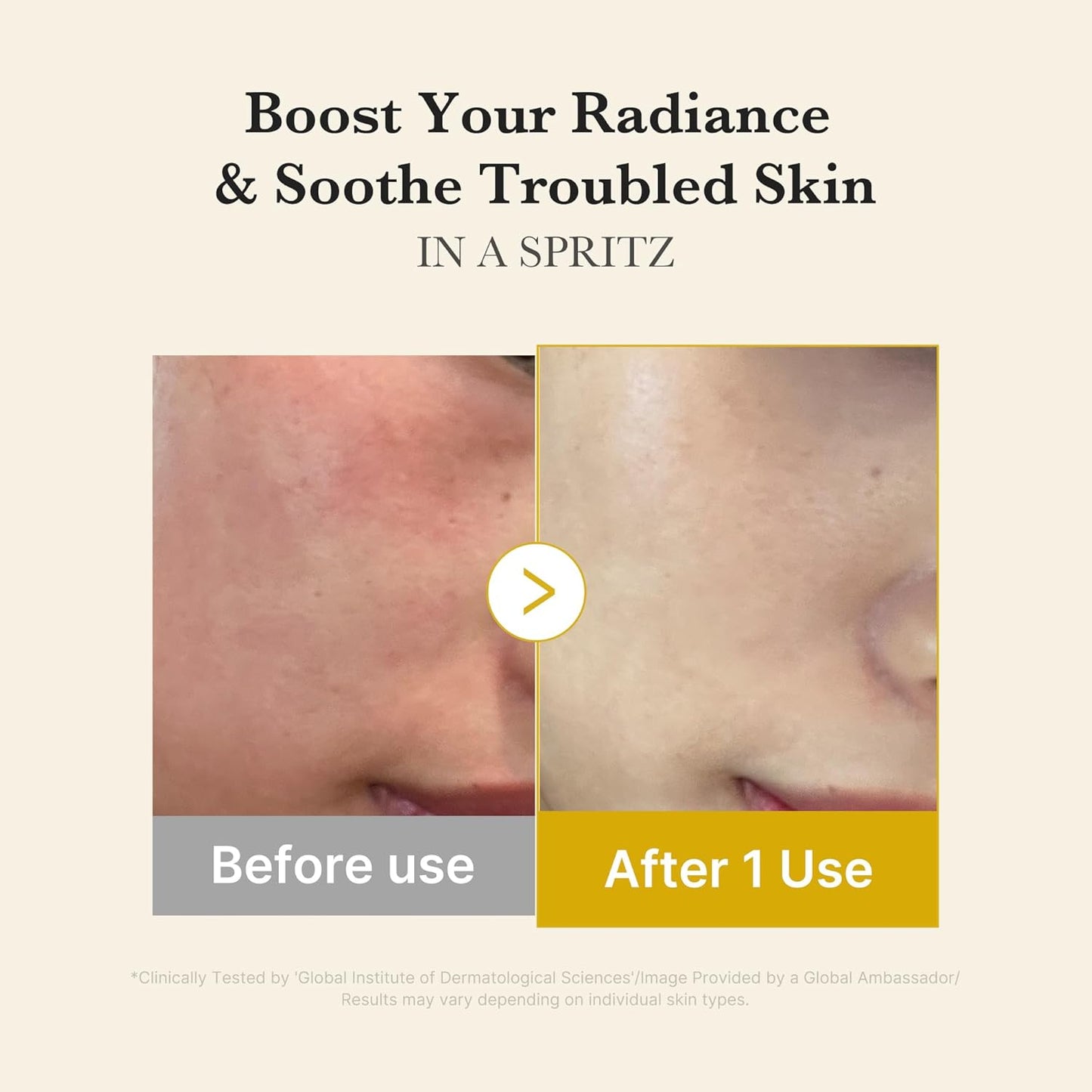 Medicube Vitamin Coric Acid Serum Mist, Spray Serum, Mist Lotion, Jelly Texture, Moisturizing Mist, Moisturizing Serum, Moisturizing Mist, Essence Mist, Dual-Layer, Lotion, Sensitive Skin, Dry Skin