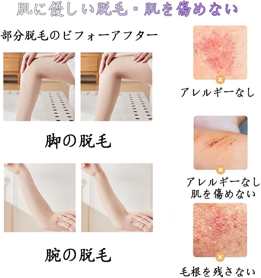 Next-Generation Hair Removal Device, Painless Hair Removal Device, Exfoliating Physical Hair Removal, Palm Size, Lightweight, Unisex, Easy Operation, No Pain, For Beginners, Household, Business Trip