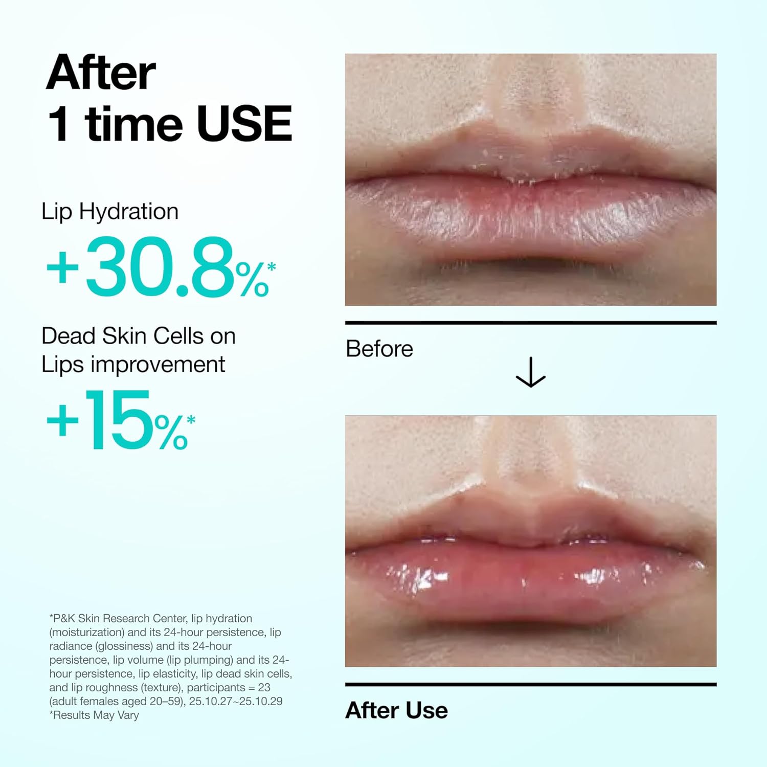Anua PDRN - Suero labial, hidratación de larga duración para labios secos y agrietados, cuidado labial hidratante no pegajoso con ADN de salmón, ácido hialurónico y colágeno, cuidado de la piel coreano, 0.33 onzas líquidas
