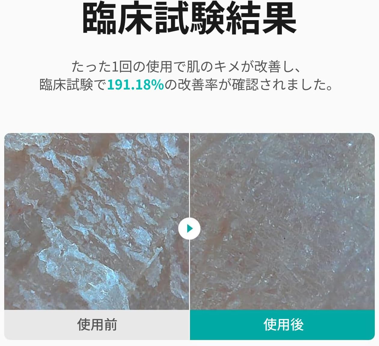 REJURAN Moisturizing Toner, 5.3 fl oz (150 ml) c-PDRN PDRx Lotion, Korean Cosmetics