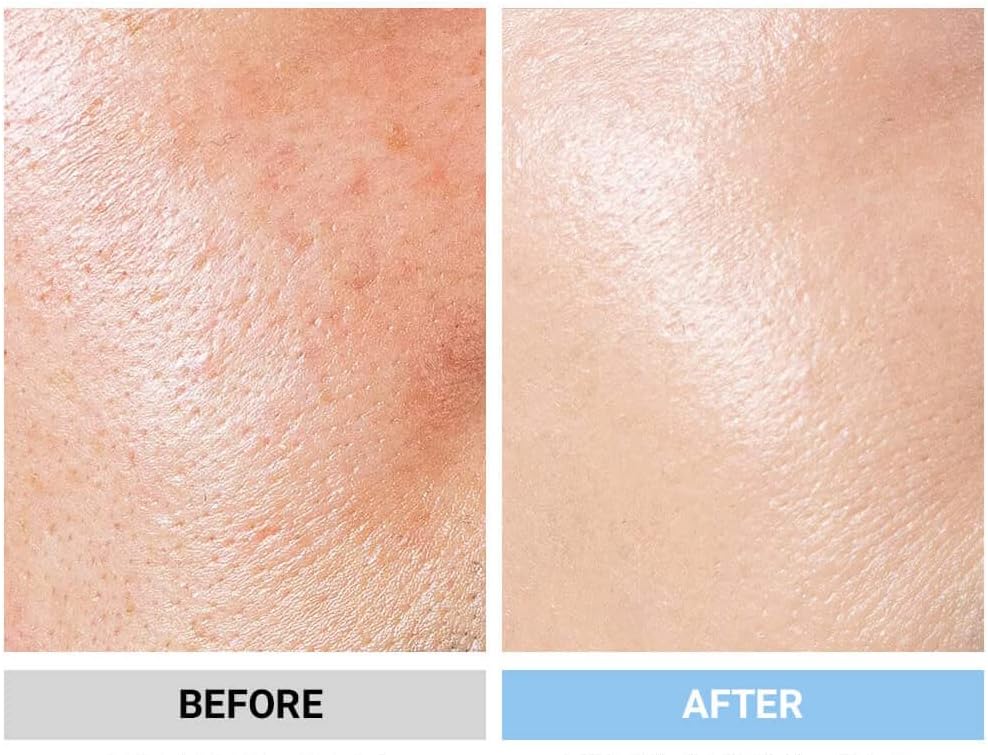 moremo Blemish Cover, BB Cream (Japan Authorized Dealer), Makeup Base, Sunscreen, Dullness, Acne, Semi-Matte (Light Beige)