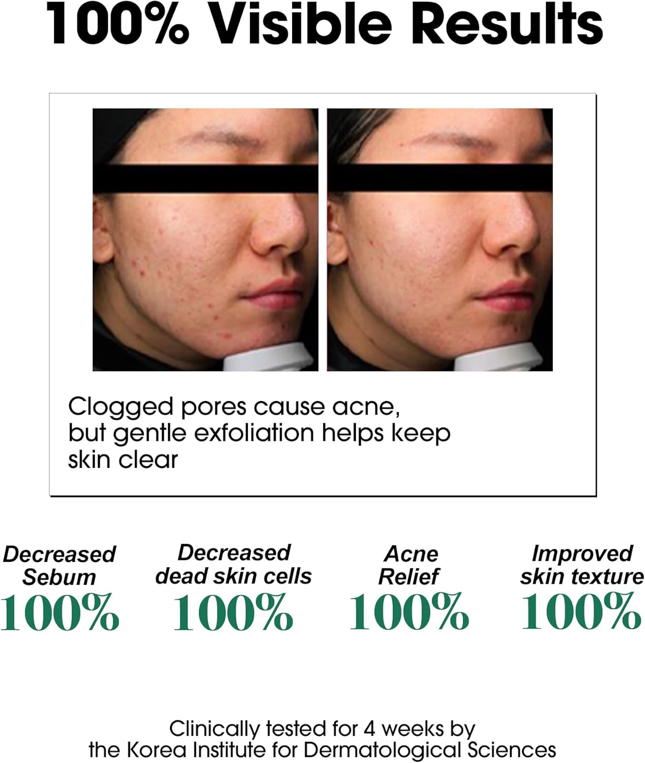 Ifactory SomeByMi Aha.Bha.Pha 30Days Miracle Toner 150ml 5oz