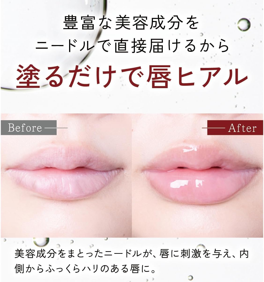 AGARISM Q+Me Bomb Shot Lip Plumper, Lip Plumper, Lip Brand, Transparent, Hyaluronic Acid, Collagen, Moisturizing, Human Stem Cells, Plumper, Lip Gloss, Lipstick, Lip Base, Lip Balm, Lip Care, Lip