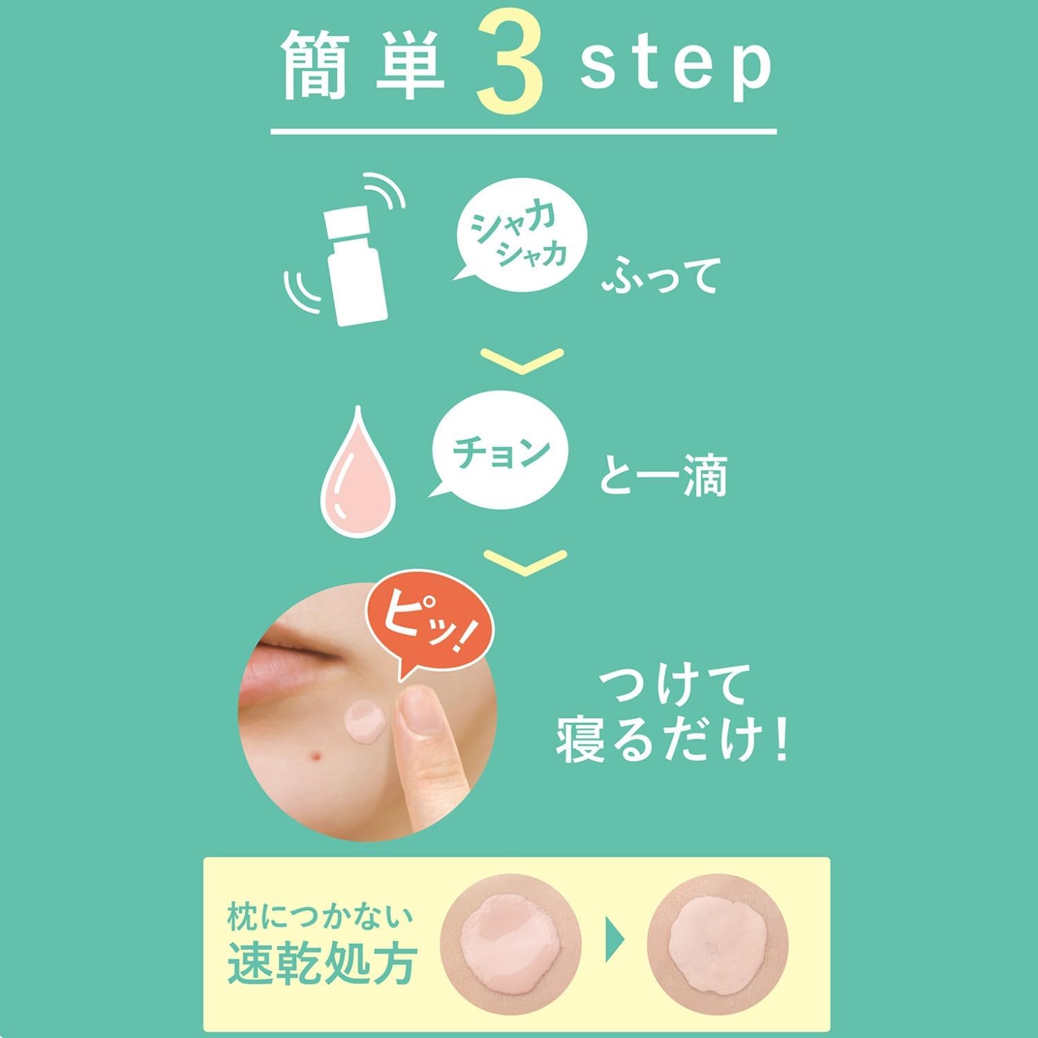 Time Rescue Nikitol Medicated Acnes Spot Paste, Quasi-Drug, Acne Prevention, For Sleeping, Intensive Care, For Night, Quick Drying, 0.5 fl oz (14 ml)