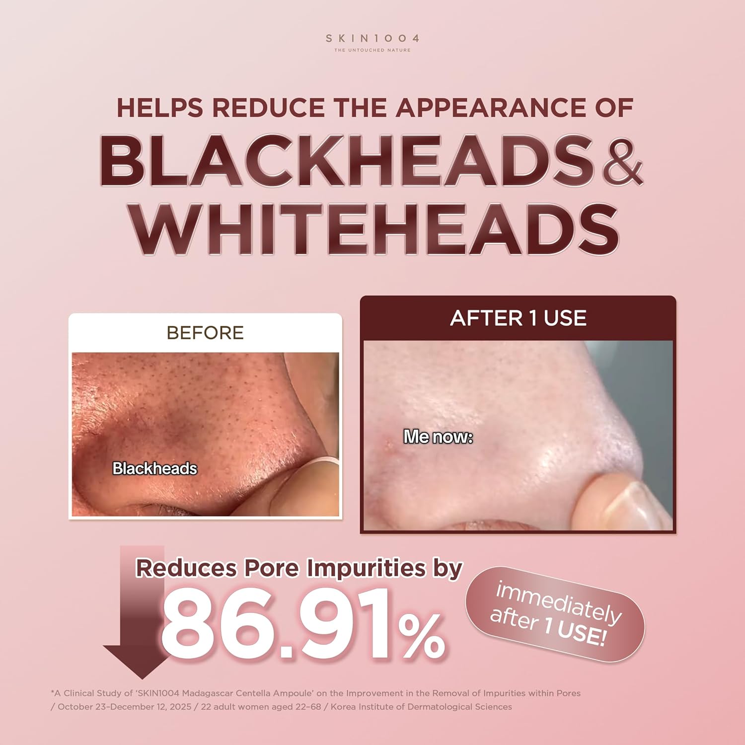 SKIN1004 Máscara de Barra de Arcilla Rápida Poremizing 27g, 0.95oz, Tratamiento Facial Coreano para Minimización de Poros, Máscara de Arcilla Rosa con Sal Rosa del Himalaya y Centella de Madagascar