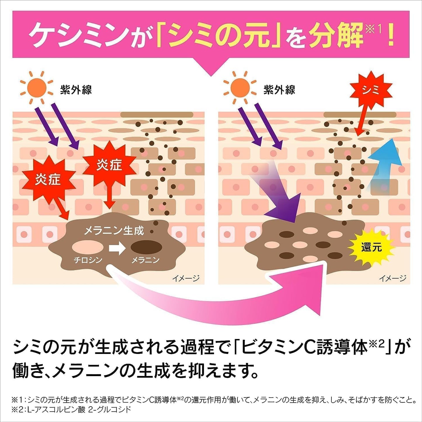 [Official] Keshimin Penetrating Lotion, Moist & Moist and Moist Refill, Formulated with Vitamin C Derivatives and V White C, For Prevention of Freckles, Keshimin [Kobayashi Pharmaceutical] Quasi-Drug