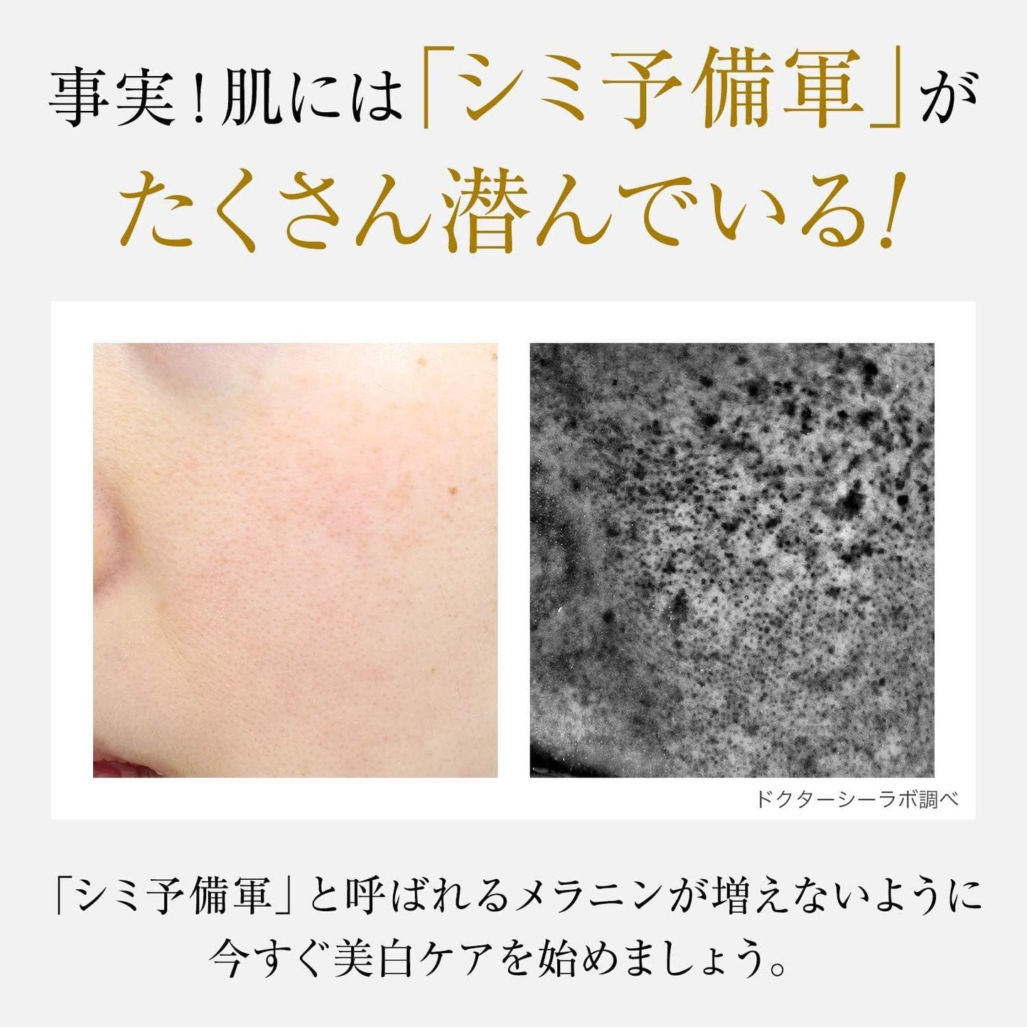 (Old Model) Medicinal Aqua Collagen Gel Whitening EX 1.8 oz (50 g) Brightening [Lotion, Serum, Milky Lotion, Cream, All-in-One Gel], All-in-One Gel, Vitamin C, Highly Moisturizing, Pores, Chloasma,