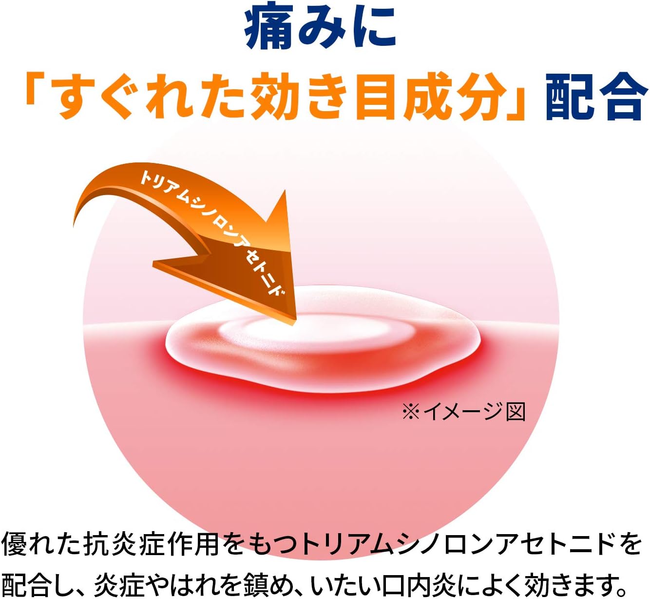 【指定第2類医薬品】アフタガード 5g