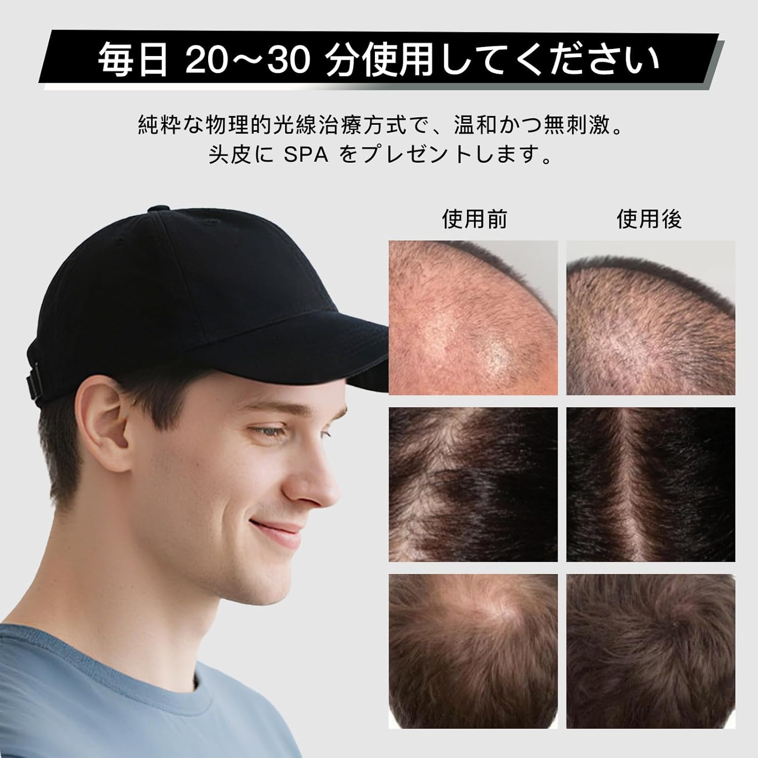 育毛キャップ 青色LED 赤色LED 頭皮 赤色光キャップ 育毛キャップ 増毛 スカルプケア 男女兼用 発毛促進 発毛 養毛 脱毛 薄毛 かんたん操作 56灯 450nm-850nm 「取り外し可能」他の帽子に交換することができます (black)