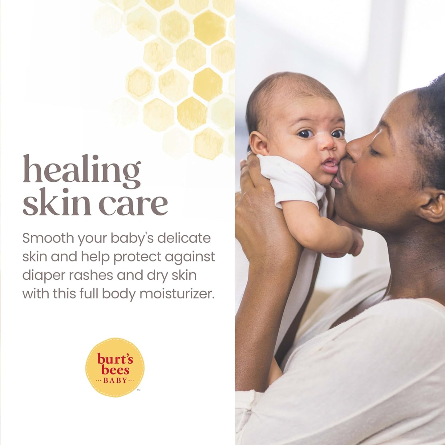 Burt 's Bees ungüento 100% natural multipropósito para bebé, 7.5 onzas (el paquete puede variar)