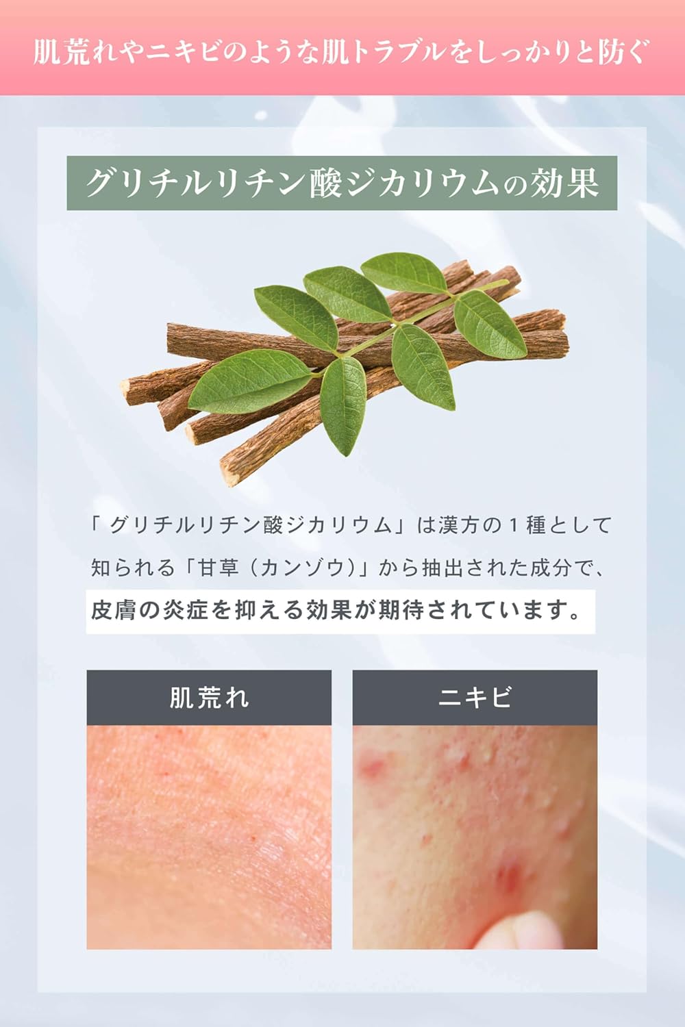 NALC Lotion, Highly Moisturizing, Heparin Similar, Sensitive Skin, Acne, Rough Skin, Skin Care, Quasi-Drug, 6.7 fl oz (190 ml)