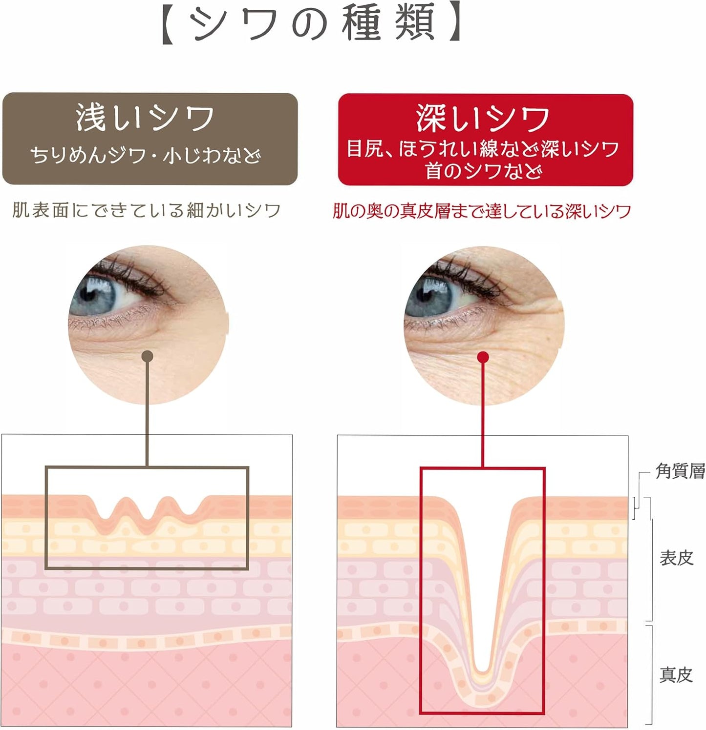 Pesca Medicated Wrinkle White Gel, Aging Care, All-in-One Gel, Medicated Wrinkle White Gel, 0.3 oz (10 g) (Not for Sale) Special Set, "Wrinkle Improvement, Whitening Care, Prevents Skin Roughness",