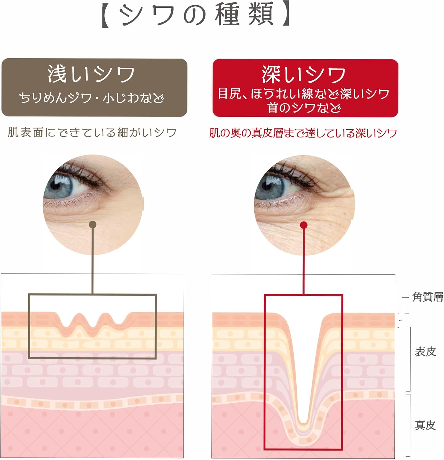 Pesca Medicated Wrinkle White Gel, Aging Care, All-in-One Gel, Medicated Wrinkle White Gel, 0.3 oz (10 g) (Not for Sale) Special Set, "Wrinkle Improvement, Whitening Care, Prevents Skin Roughness",