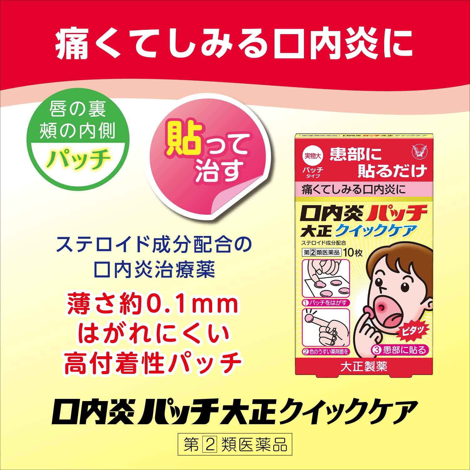 【指定第2類医薬品】口内炎パッチ大正クイックケア 10枚