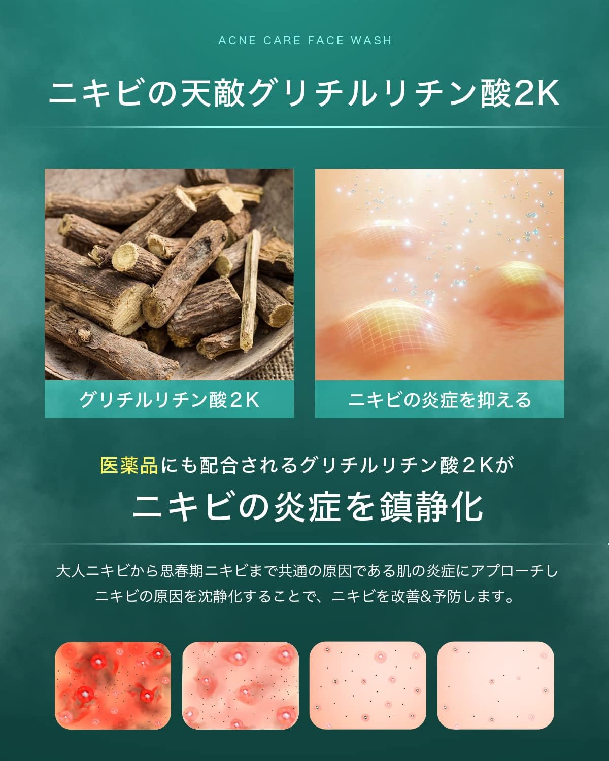 NILE Dense Foam Facial Cleansing Acne, Pores, Quasi-drug Cream Facial Wash Soap (Eucalyptus Mint Scent)