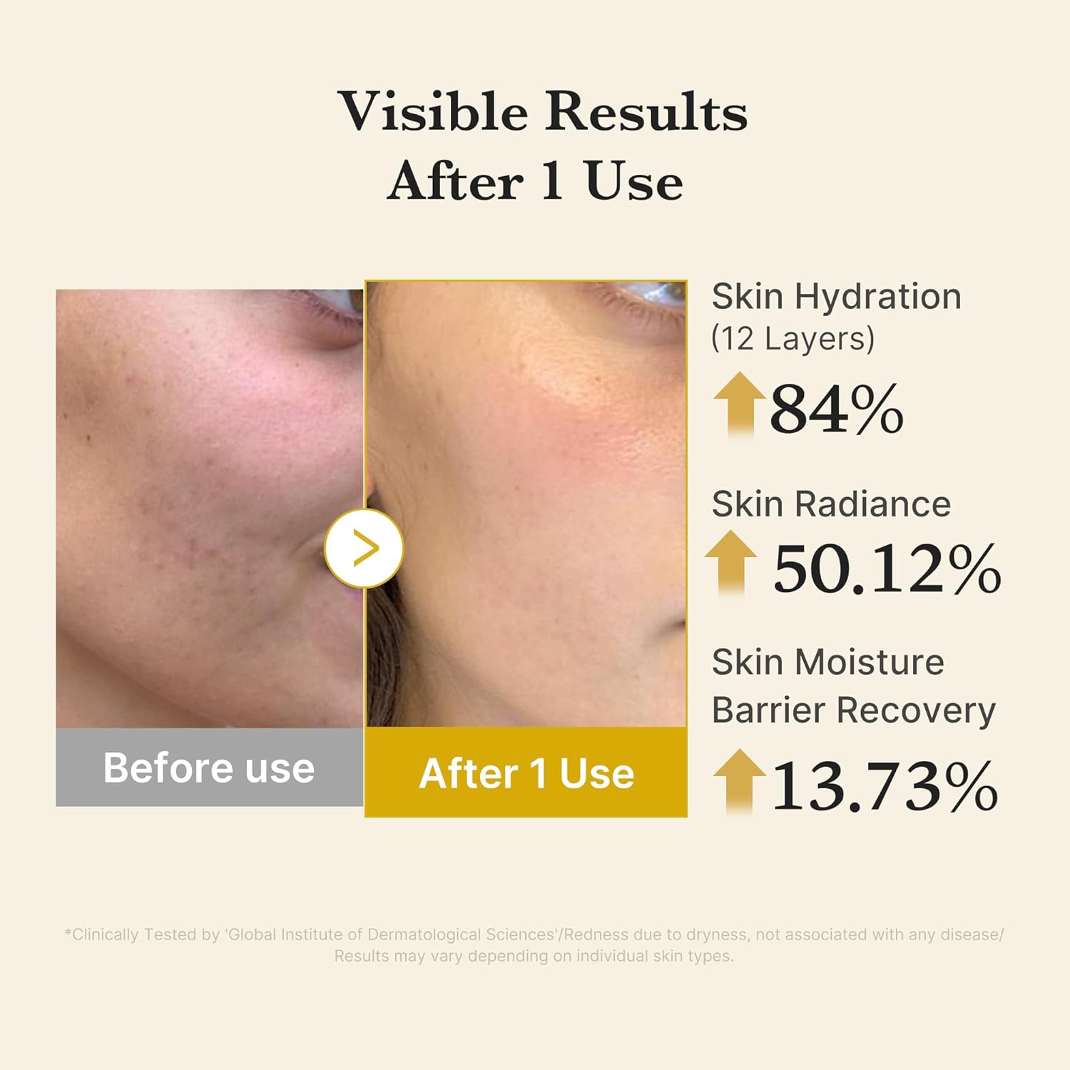 Medicube Vitamin Coric Acid Serum Mist, Spray Serum, Mist Lotion, Jelly Texture, Moisturizing Mist, Moisturizing Serum, Moisturizing Mist, Essence Mist, Dual-Layer, Lotion, Sensitive Skin, Dry Skin