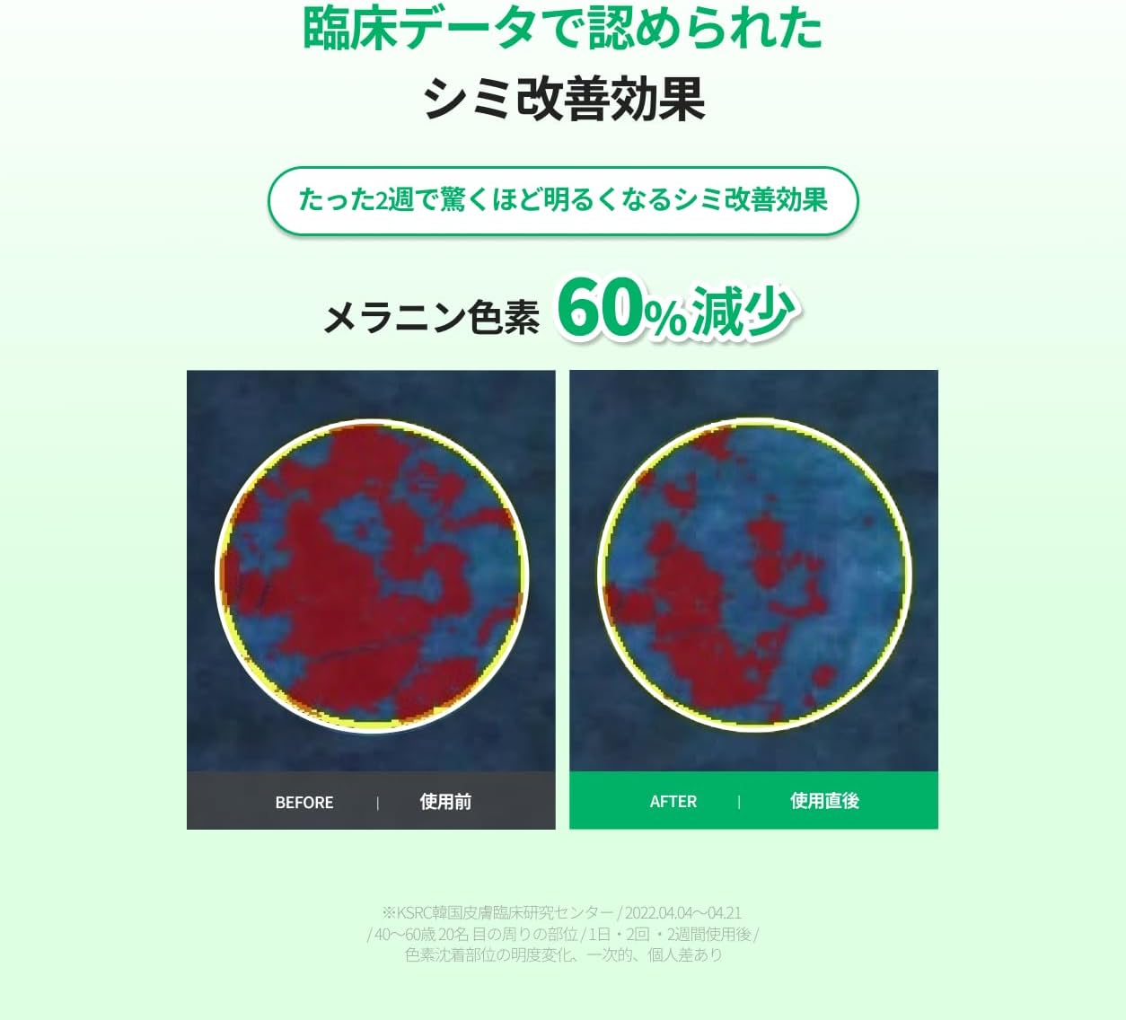 [Official] Easy Dew Mela One Day Serum, 0.3 fl oz (10 ml) (Stains/Dullness/Tone Up/EGF/Skin Barrier/Doctor's Skin Care)